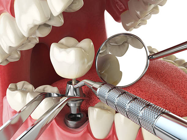 Best Cosmetic Emergency Dentistry in Holliday, TX