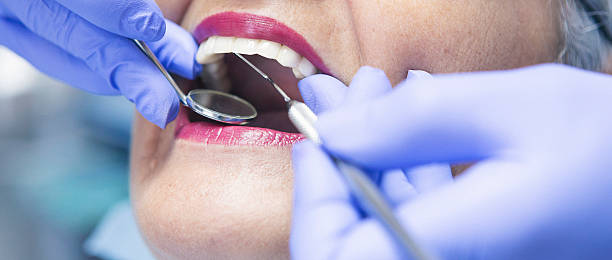 Best Emergency Tooth Extraction in Holliday, TX